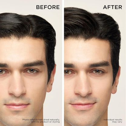 Dr. Groot Thickening Shampoo & Scalp Treatment Set for Hair Loss